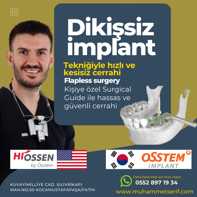 Osstem ve Hiossen İmplant Fiyatı 2024